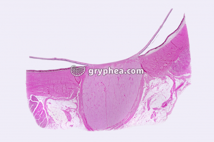 Tache aveugle Nerf optique x1,5 - gryphea.org